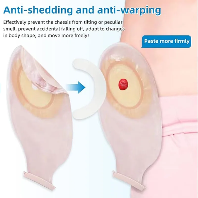 Medical Tape - Striscia di Rinforzo per Sacche Ostomiche,